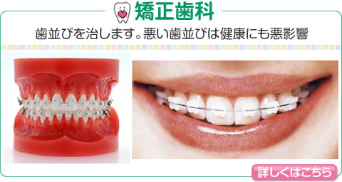 矯正歯科　歯並びを治します。悪い歯並びは健康にも悪影響