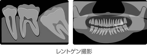 予防歯科 そね歯科医院は 宇都宮市の歯医者の中でも 早いうちから予防歯科に力を入れいます